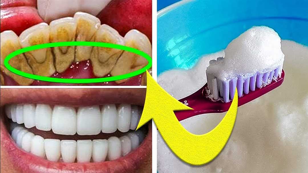 Как избавиться от желтизны зубов в Фотошопе CS6